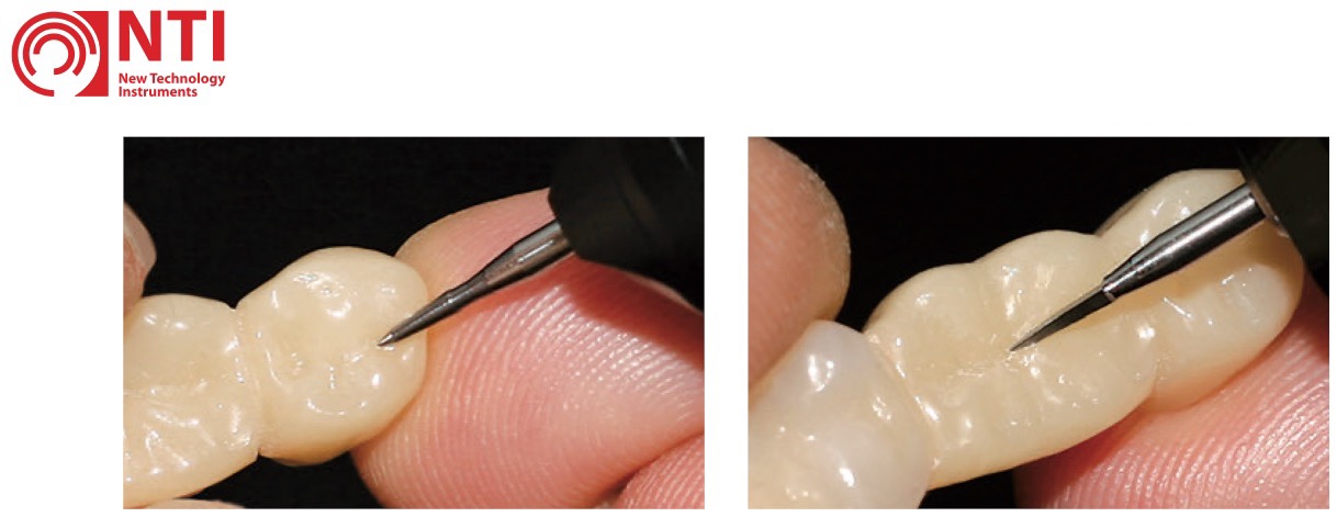 Riflettore Dental Intraorale Specchio Dentale Occlusale - Foto 13